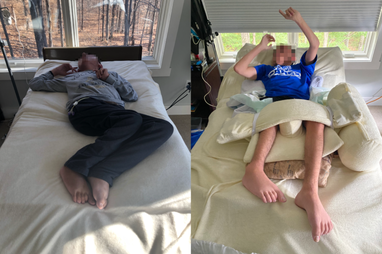 A pre-teen boy lies with limbs unsupported on the left. On the right, the same boy lies supported by therapeutic pillows.